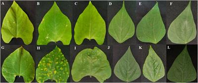 Metabolome profile variations in common bean (Phaseolus vulgaris L.) resistant and susceptible genotypes incited by rust (Uromyces appendiculatus)